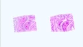 Paraffin Tissue Section - Human Adult Normal: Brain: Cerebral Cortex